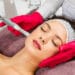 woman receiving microneedling rejuvenation treatment