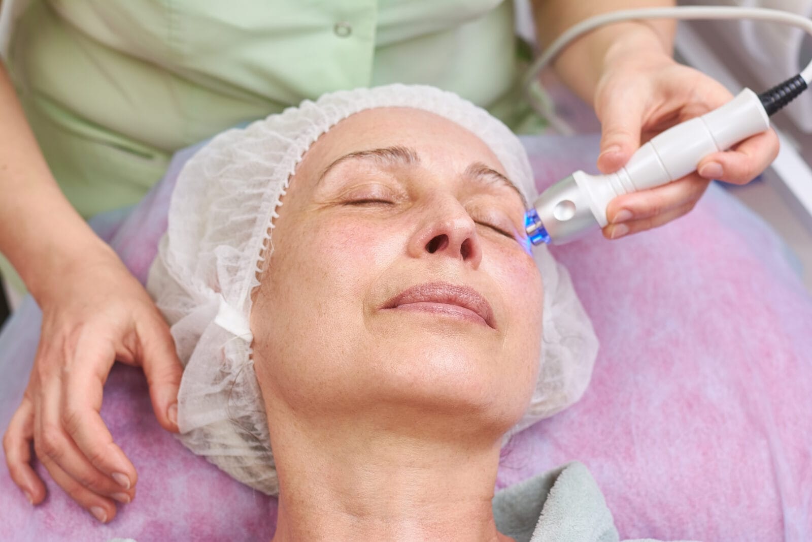 woman receiving microneedling treatment