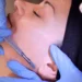 Dermaplaning Facial